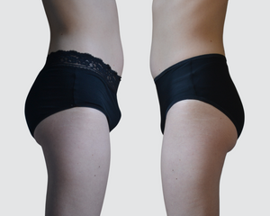 Maria - Tucking/ corrective briefs